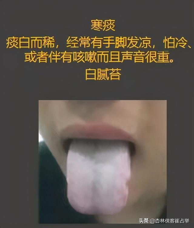 咳白痰、黄痰、清稀泡沫痰，3种情况3种原因，教你一分钟辨别