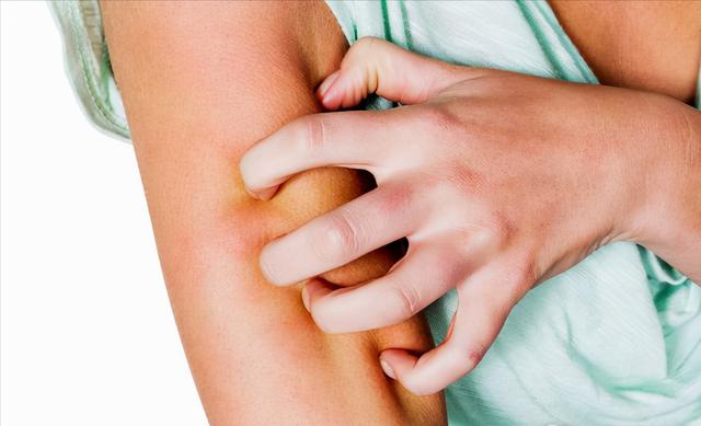 千呼万唤：这5种食物，荨麻疹患者可以多吃些