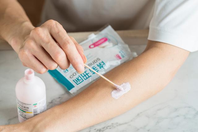 荨麻疹擦身体乳能缓解吗