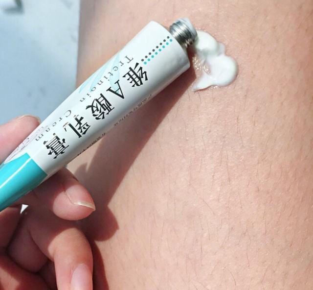 天气干燥擦了身体乳还是起鸡皮