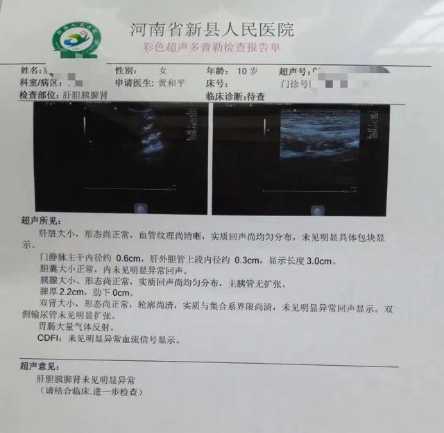 小儿腹痛，警惕肠系膜淋巴结炎