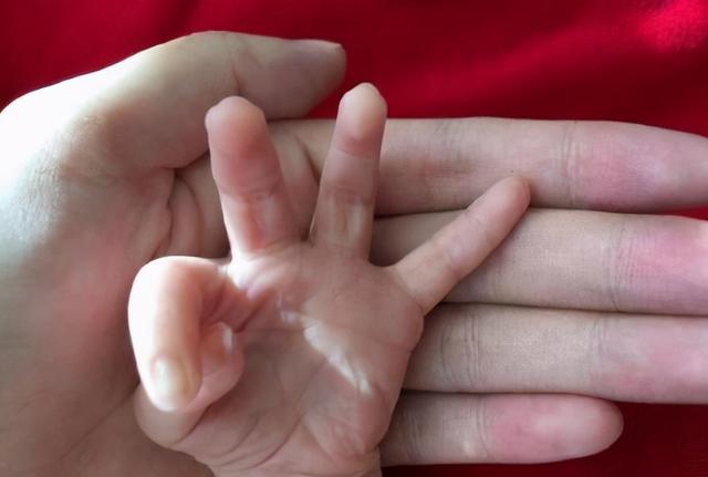 孩子聪不聪明，看看“小手”就知道一二！智商高低手掌上有信号