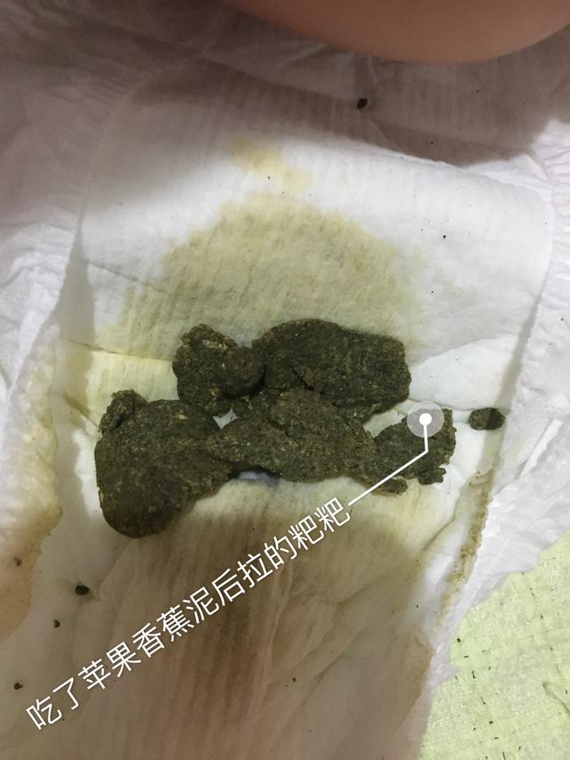 婴幼儿脾胃调理，分享自家宝贝亲测有效的方法（上）