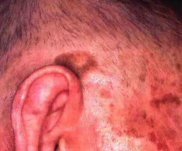 可对角化必可逆