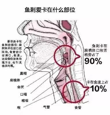 孩子喉咙里卡鱼刺，孩子被鱼刺卡喉咙怎么办专家的建议颠覆家长的认知