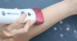 毛囊炎毛周角化知乎