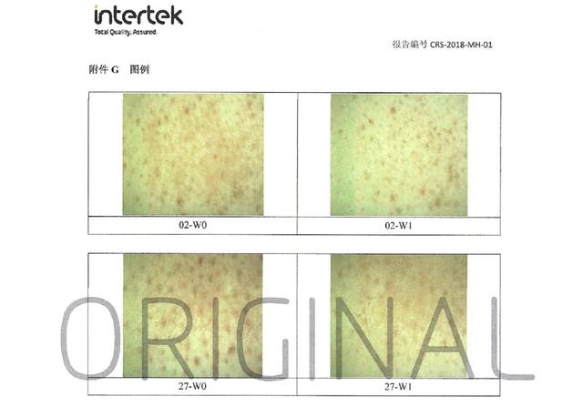 皮肤角化脱皮消银颗粒