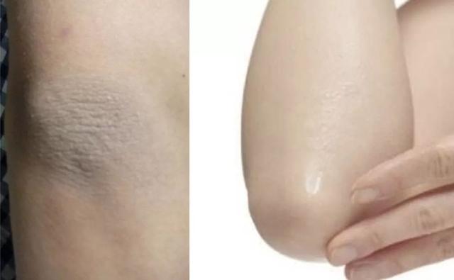 果酸身体乳能带上高铁吗