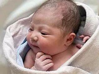 小孩脸部毛周角化图片