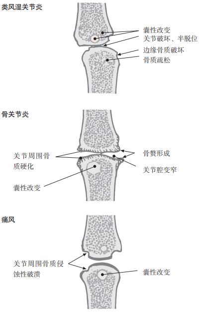 ena检查是什么意思