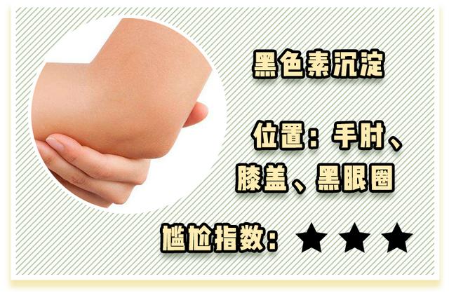 维a酸加入身体乳