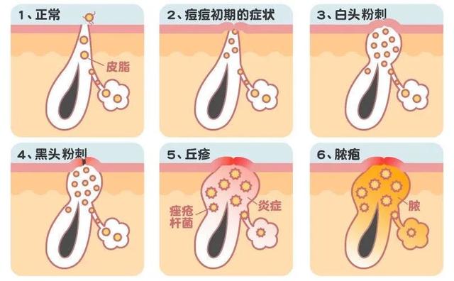 dr.wu杏仁酸精华身体乳