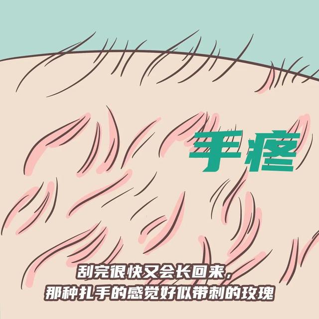 激光脱毛后涂了身体乳
