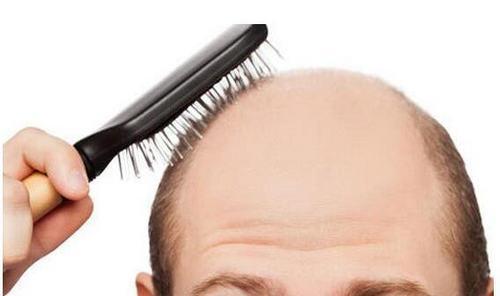 每天头发脱落不超过100根算正常，如何预防？