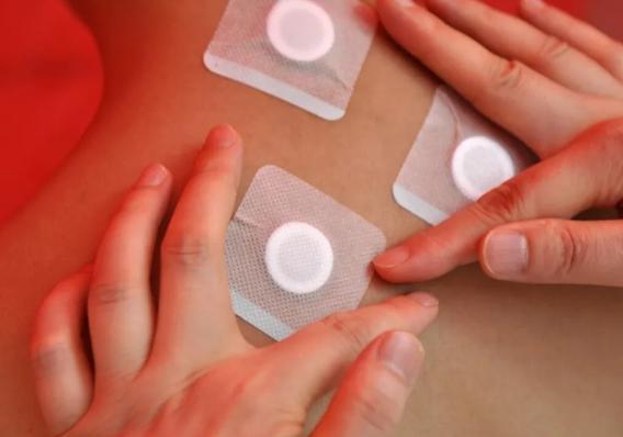 “三伏贴”敷后起泡，说明起效了