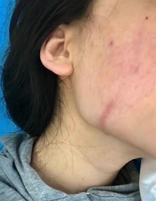 成都一女子整形医院讨说法被打成脑震荡，院方称正配合警方调查