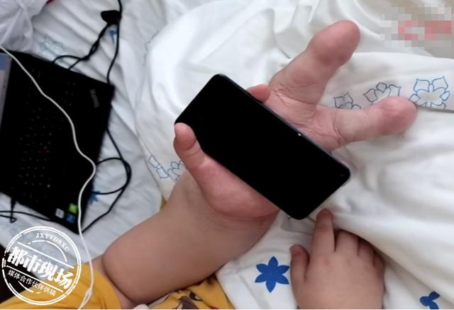 男孩手指头比香蕉还粗，医生都说没见过