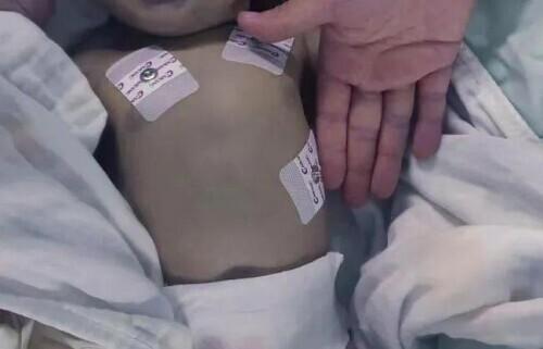 四川两家长用熬煮蔬菜水冲奶致婴儿中毒，毒素足以致死