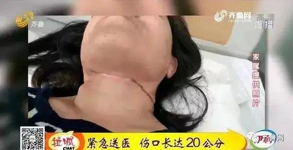 好几个孩子被划伤！假期出游，一定要警惕这个“空中杀手”