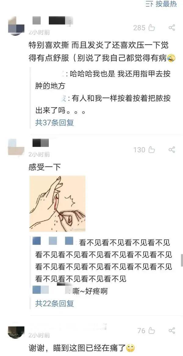 手上倒刺一直撕一直长，到底孩子缺了哪种维生素？