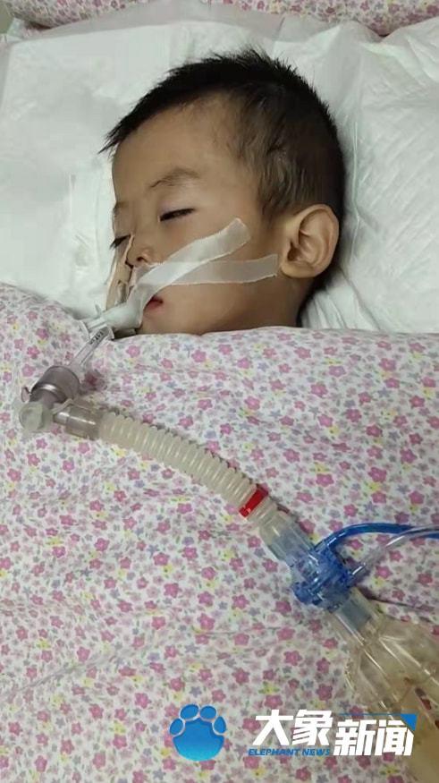 被爸爸举高高摔进ICU的男婴，已下三次病危通知书！医生：希望不大了