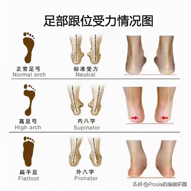 美腿与丑腿