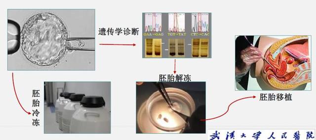 携带遗传致病基因的父母，如何生下健康后代？武汉大学人民医院这个团队给出解决方案