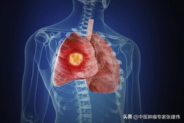 29歲抗癌博主霍九九因病去世！為什么不抽煙的女性會得肺癌？