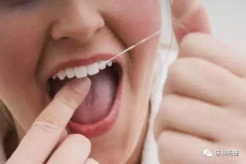 牙线怎么用（塑料牙线怎么用）