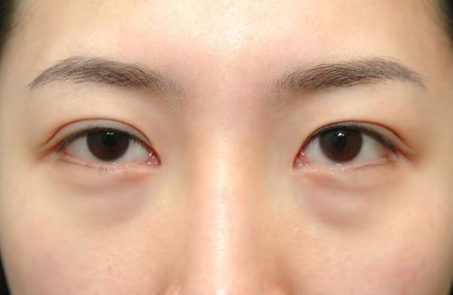 胃不好的人，脸上或许会有3种表现，记得提醒家人，望你提前了解