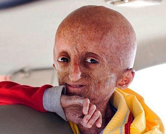 7种可能“无法治愈”的疾病，你了解多少？一起来看看吧