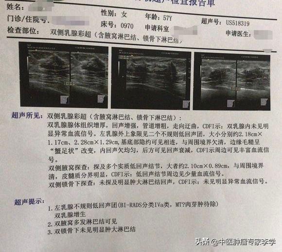 乳腺癌患者中晚期，該如何用藥？