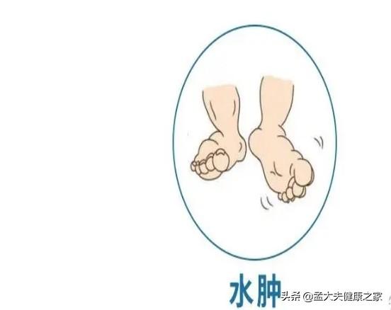 尿酸检查项目n是什么意思