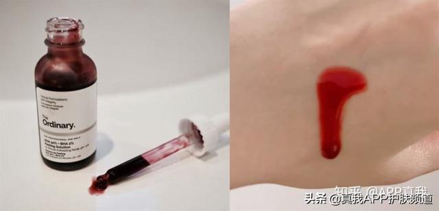 脸颊靠近耳朵处鸡皮疙瘩