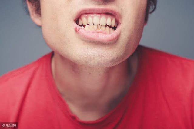 教你去除牙结石的3种方法,简单去除牙结石的方法