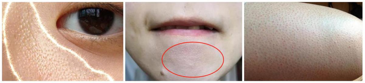 delon身体乳会长毛吗