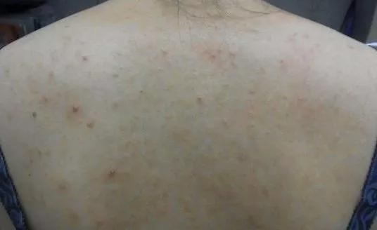 手工皂洗鸡皮肤