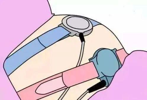 胎心180次，肚子发紧孕妈都怕怕