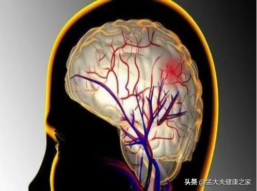 老年人预防脑梗与老年痴呆，如何补充叶酸与B12很重要，请看此文