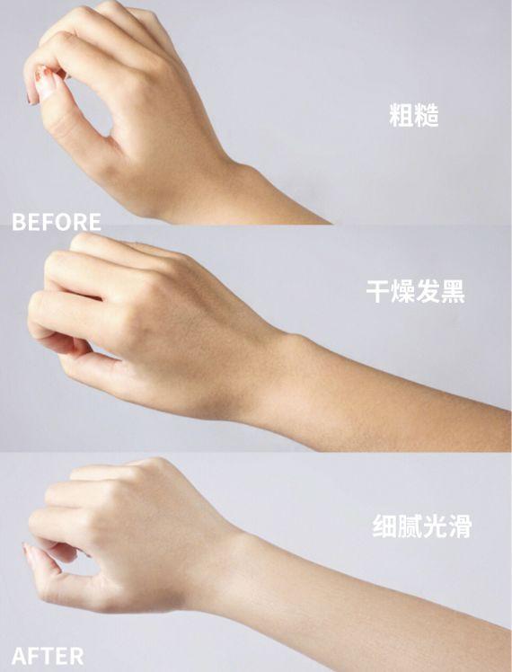 手背皮肤就长鸡皮一样