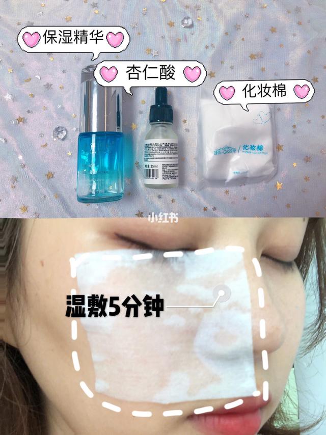 毛质角化症多大可以消除