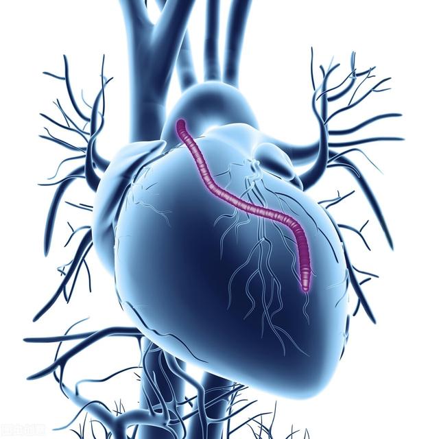 心脏不好、血压高？可能是因为你有这5个习惯，现在改还来得及
