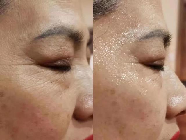 为什么皮肤会衰老怎么抗衰老