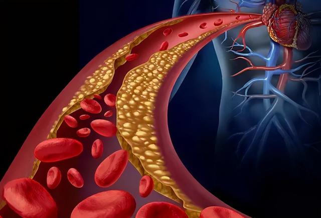 丹参泡水能通血管？这事靠谱吗？听听中医主任医师怎么说