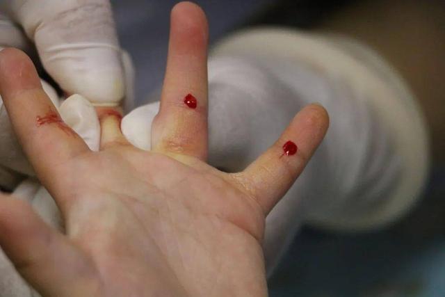 宝宝不吃饭日渐消瘦可能是疳积,欧阳医生教你辨别孩子是否有疳积