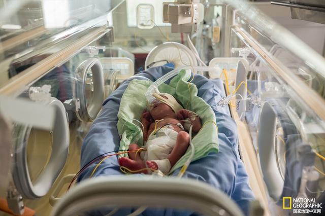 科普：治疗婴儿疼痛为何如此困难？