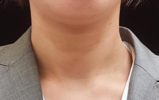 身体乳使用年龄