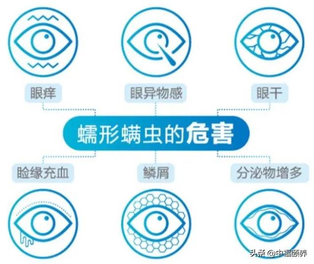 关注眼部健康，别让干眼症找上门