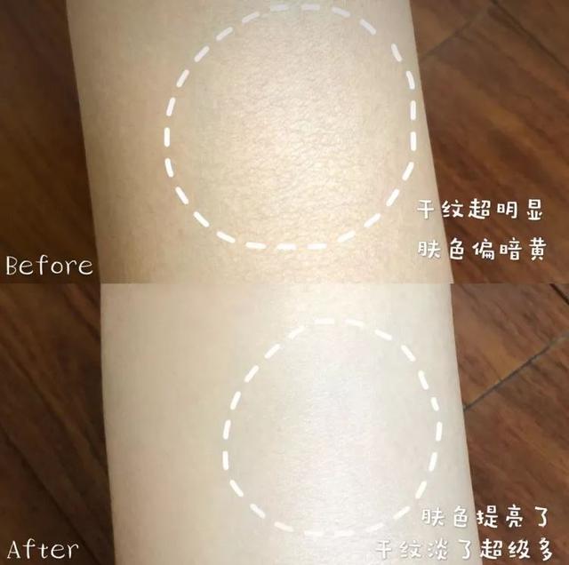 手背皮肤就长鸡皮一样