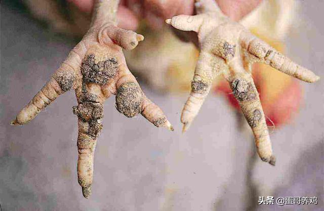 治疗鸡皮肤的五种方法